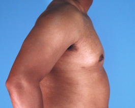 Male Surgical Procedures, Hubbard Plastic Surgery