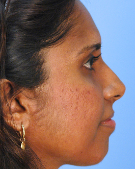 Skin Care Products Before and After | Dr. Thomas Hubbard